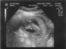 ultrasound_1 * 2670 x 1995 * (986KB)