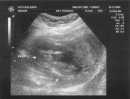 ultrasound_3 * 2625 x 2010 * (1.37MB)