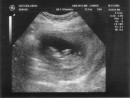 ultrasound_4 * 2674 x 2030 * (1.4MB)